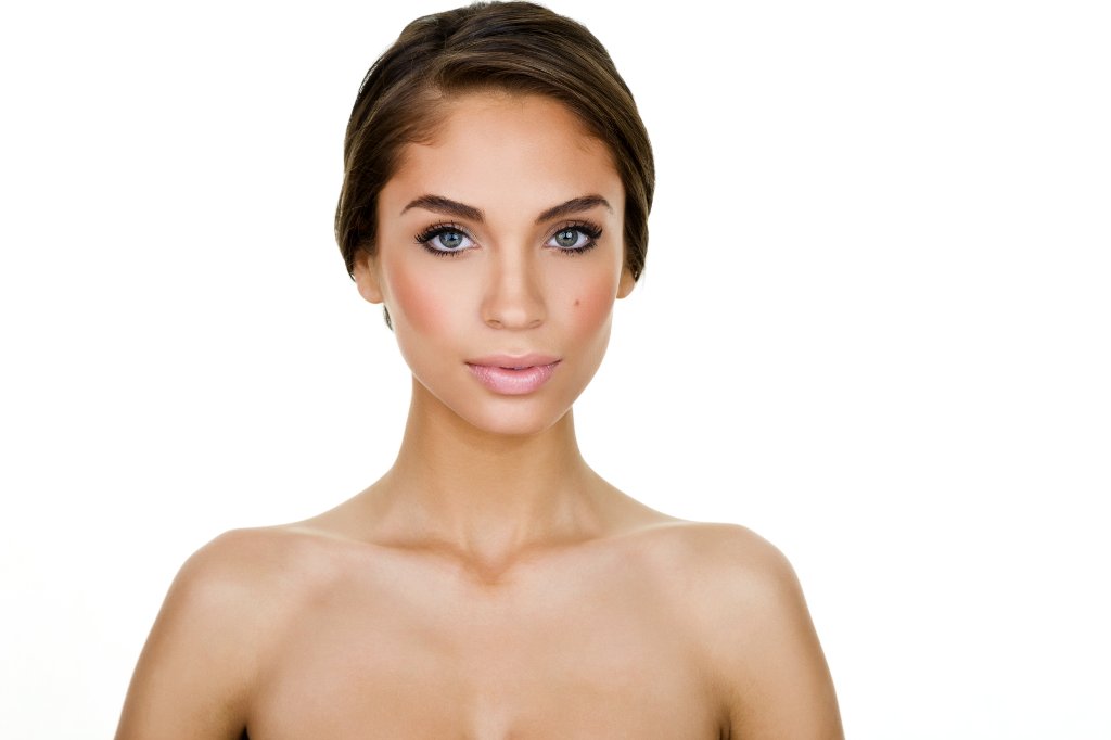 Rhinoplastik und Septorhinoplastik bei einer weiblichen Patientin